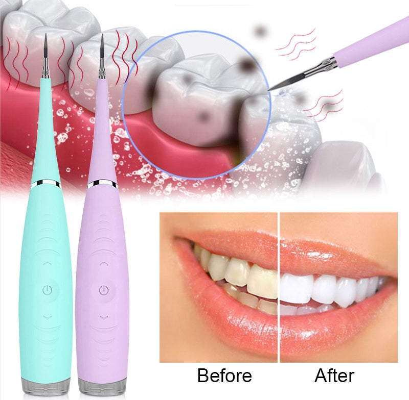 Electric Dental Calculus Remover, Sonic Tooth Scraper Plaque Tartar Stain Remover for Teeth High Frequency Vibration Teeth Cleaning Tools Kit with LED USB Rechargeable